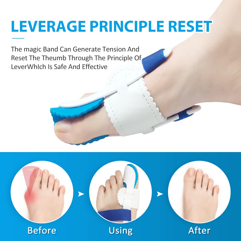 Correcteur d'Orteil Hallux Valgus